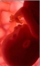 Embryo