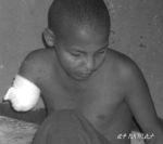 Abdulekerim, age 15, lost his right arm on Butajira conflict Abdulekerim, age 15, lost his right arm on Butajira conflict